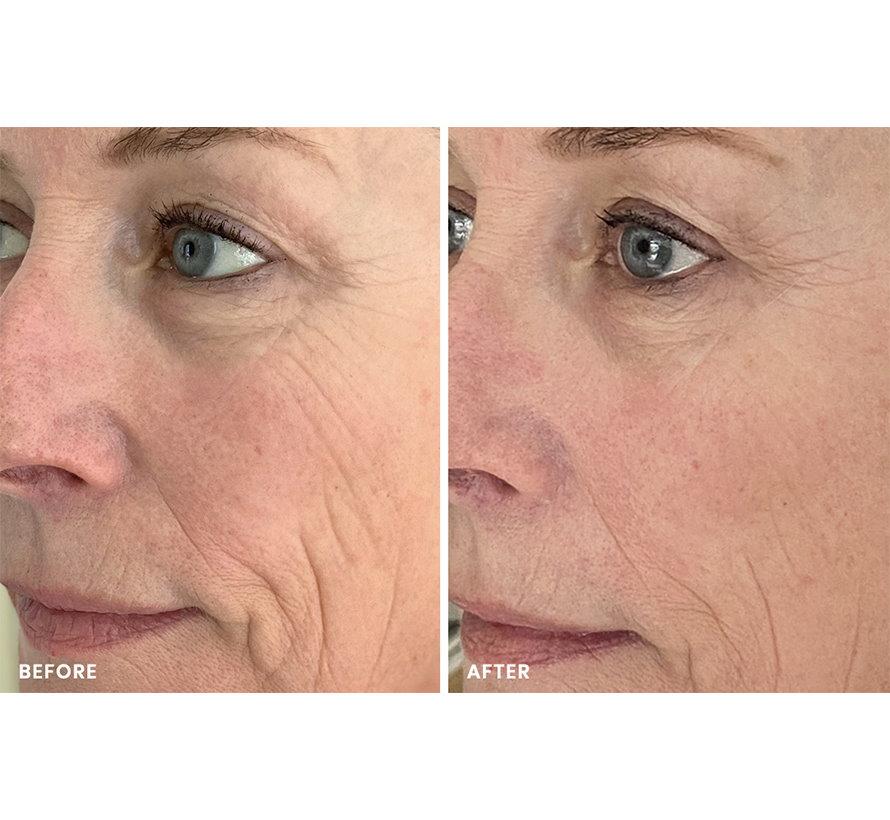 It's a Miracle 8 Minute Mask- Single Sachet - Image 9