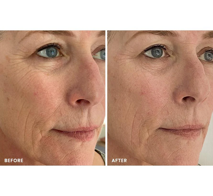 8 MINUTE MASK - Image 10