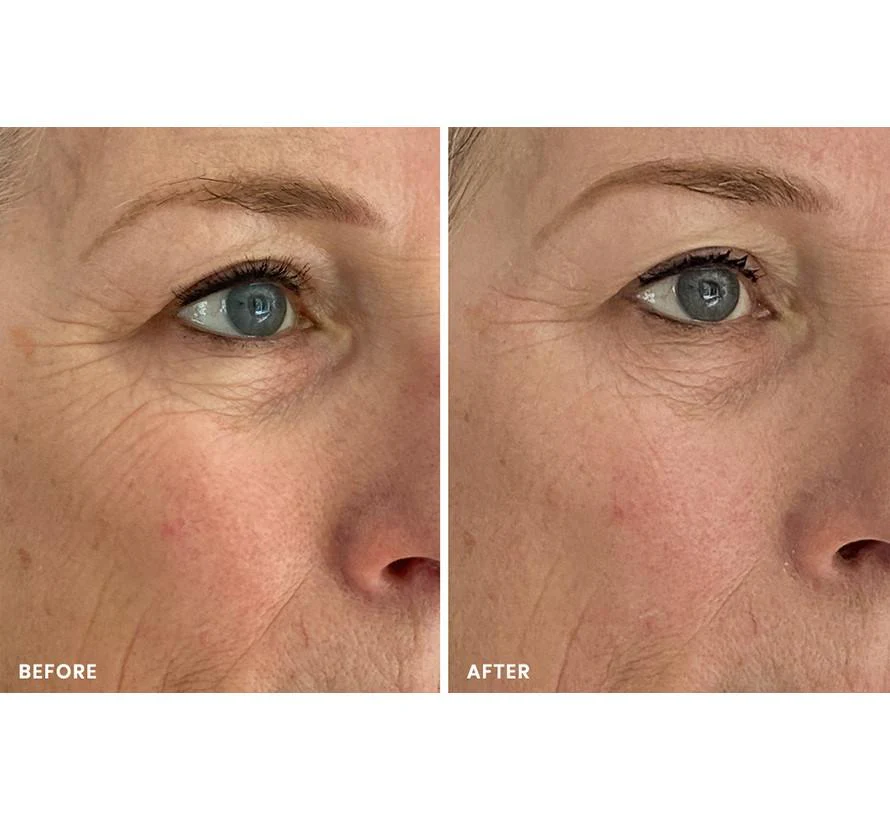 8 MINUTE MASK - Image 11