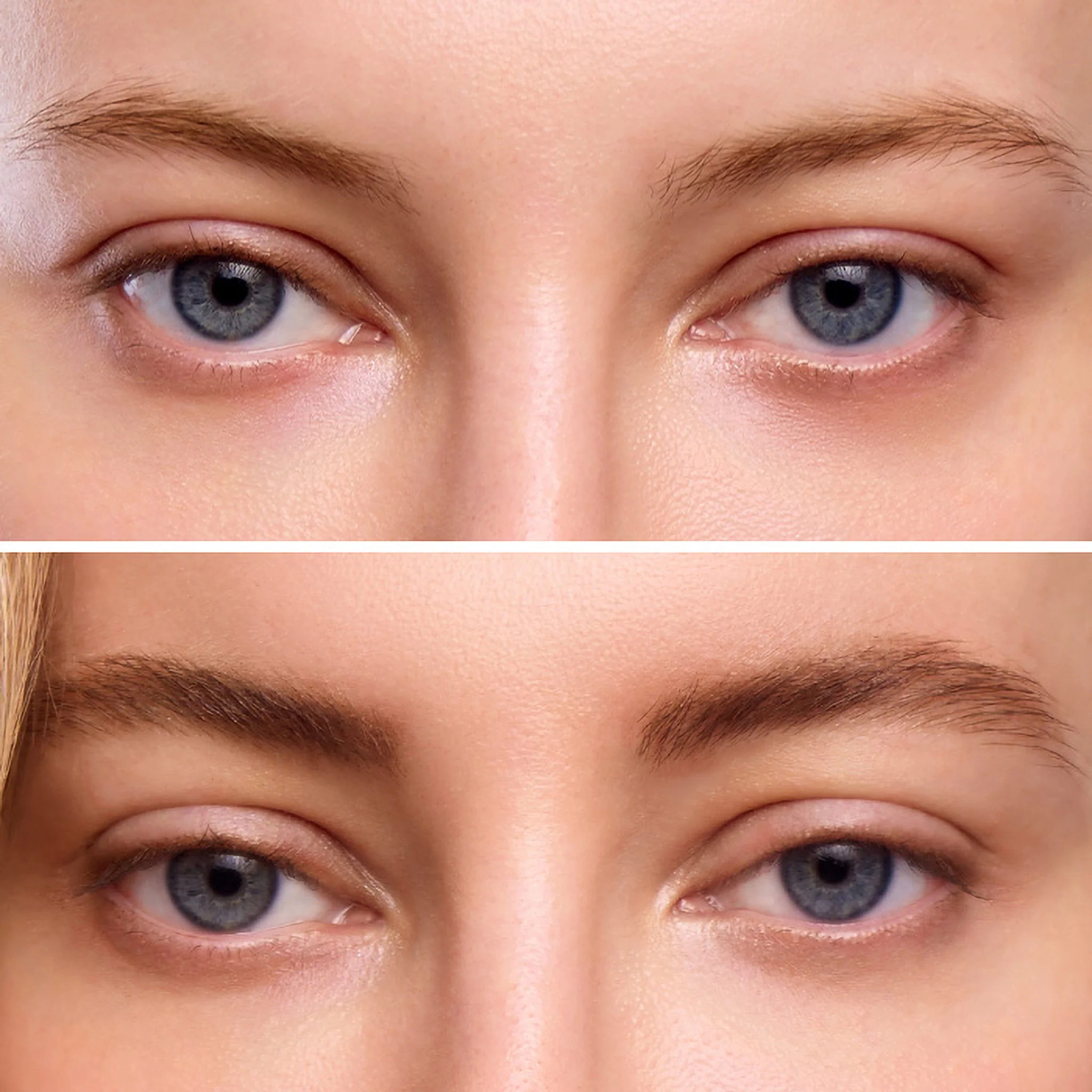 Wonderskin Essentials Set - Image 10